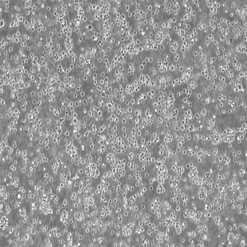 人T淋巴细胞白血病细胞（Jurkat（clone E6-1））