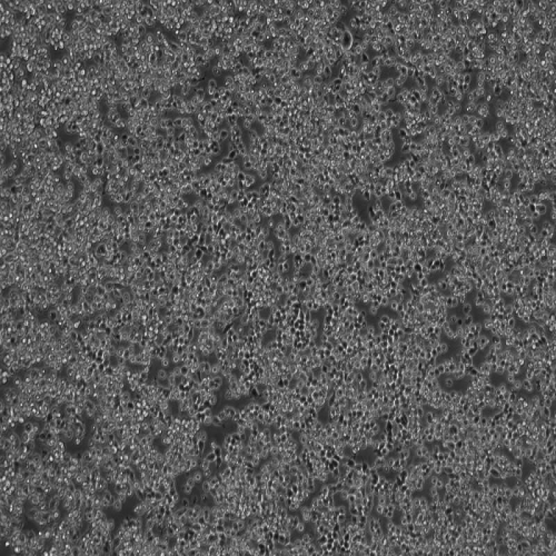 小鼠单核巨噬细胞白血病细胞(RAW 264.7)
