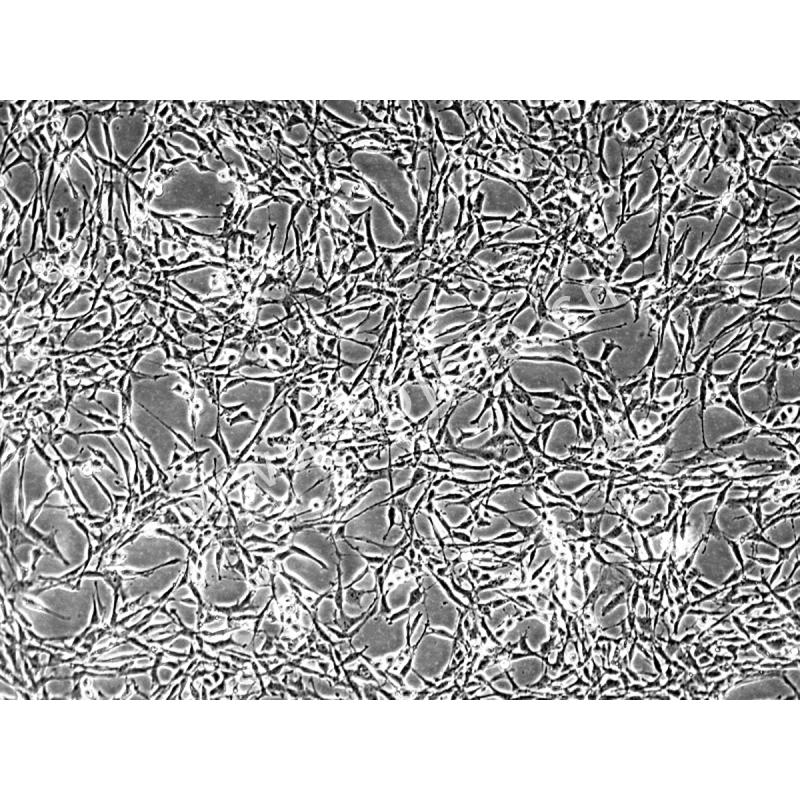 大鼠胶质瘤细胞(C6)